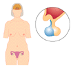 Menopause illustration
