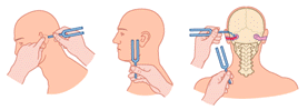 Hearing test illustration