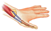 RSI illustration
